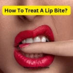 How To Treat A Lip Bite